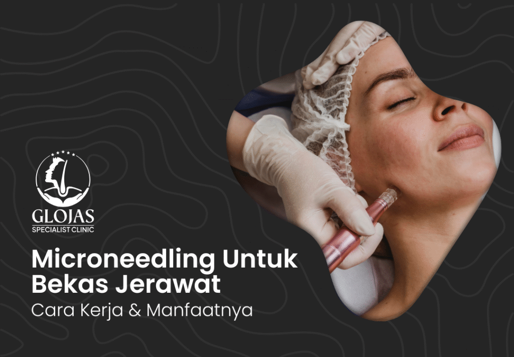 microneedling-malaysia