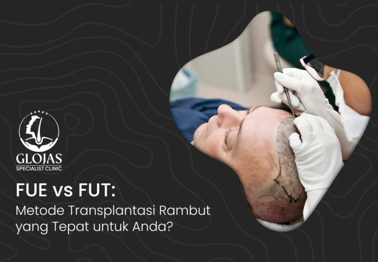fue-fut-methode-transplantasi-rambut