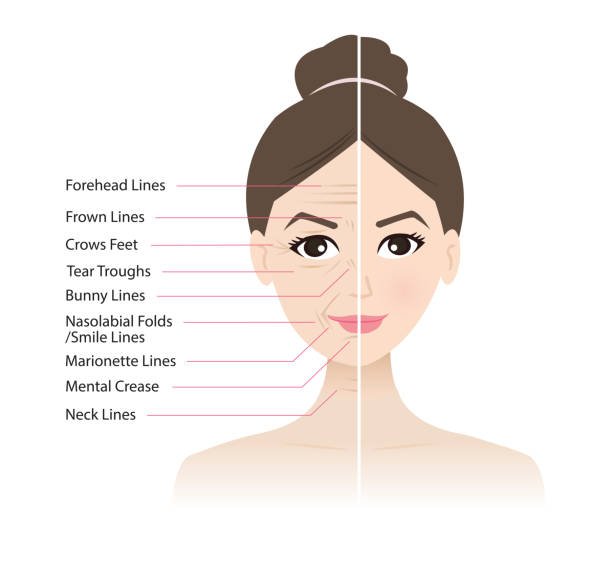 botox-indonesia