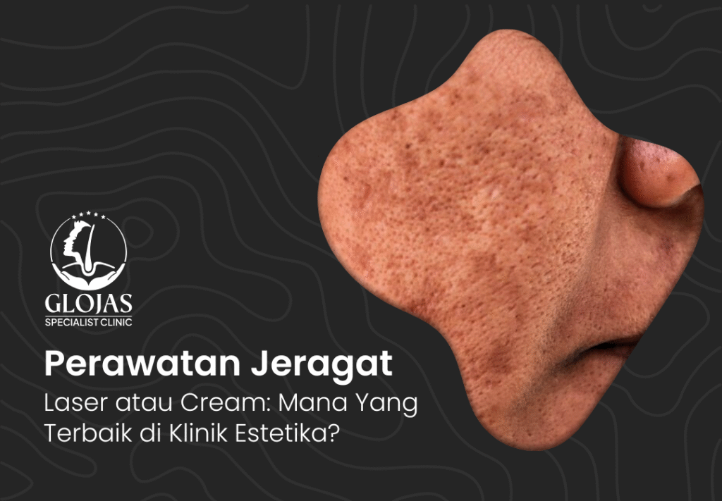 jeragat