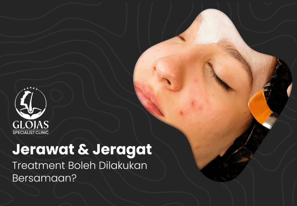 jerawat-jeragat