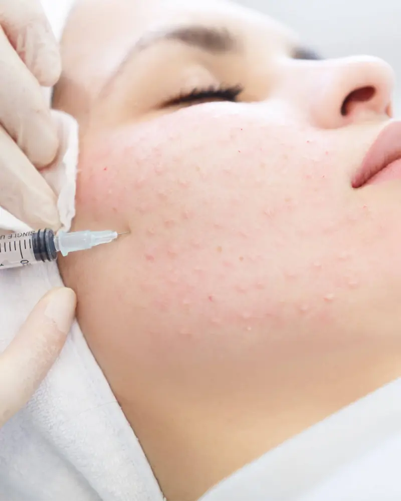Skin Booster