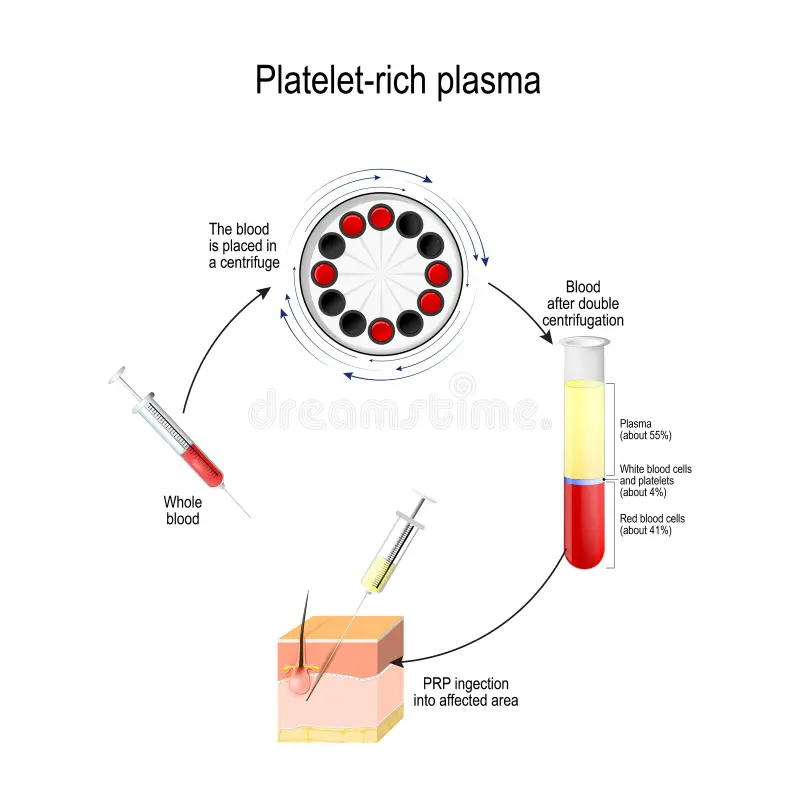 prp-facial-indonesia