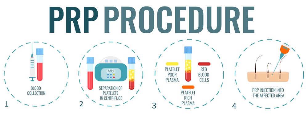 prp