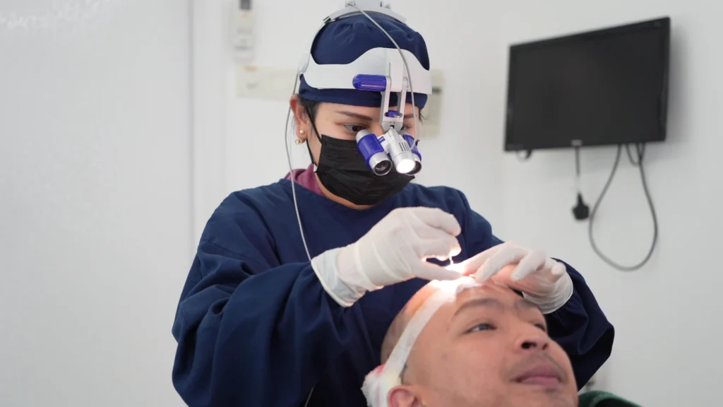 tanam-rambut-indonesia-fue-fut-hair-transplant-jakarta