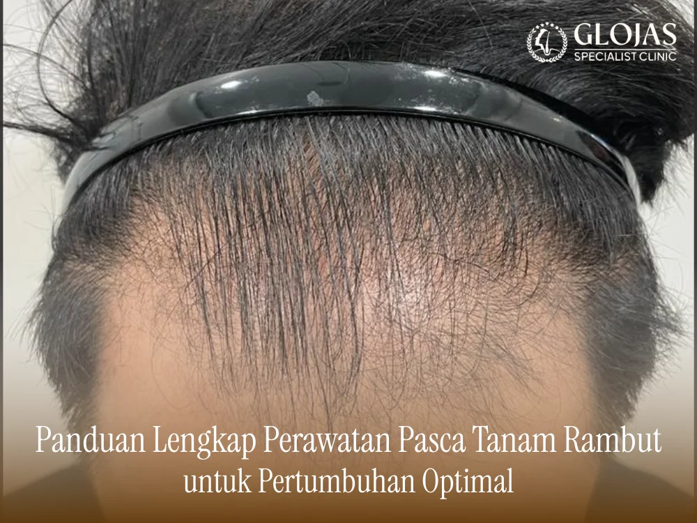 pasca-tanam-rambut