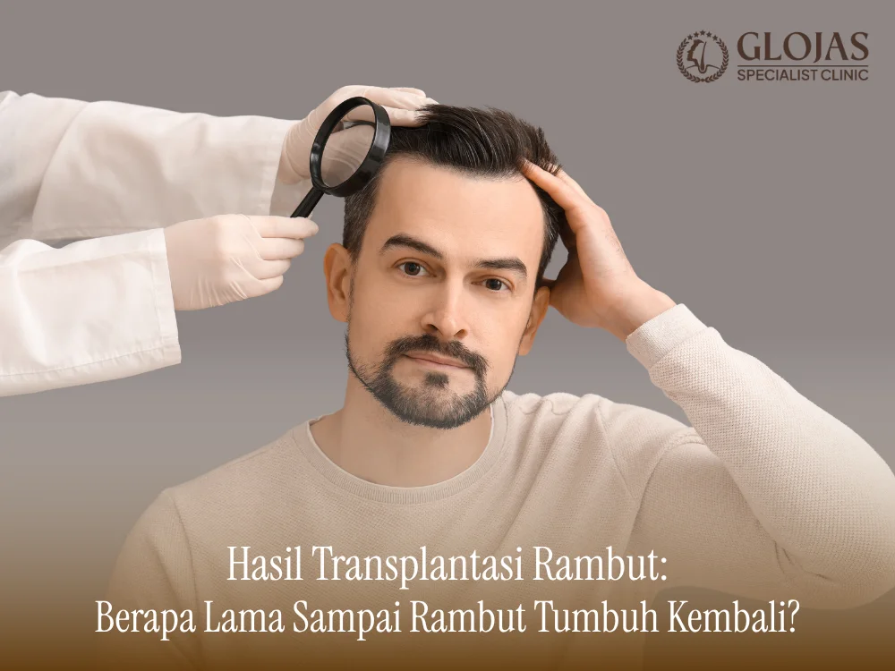 hasil-transplantasi-rambut