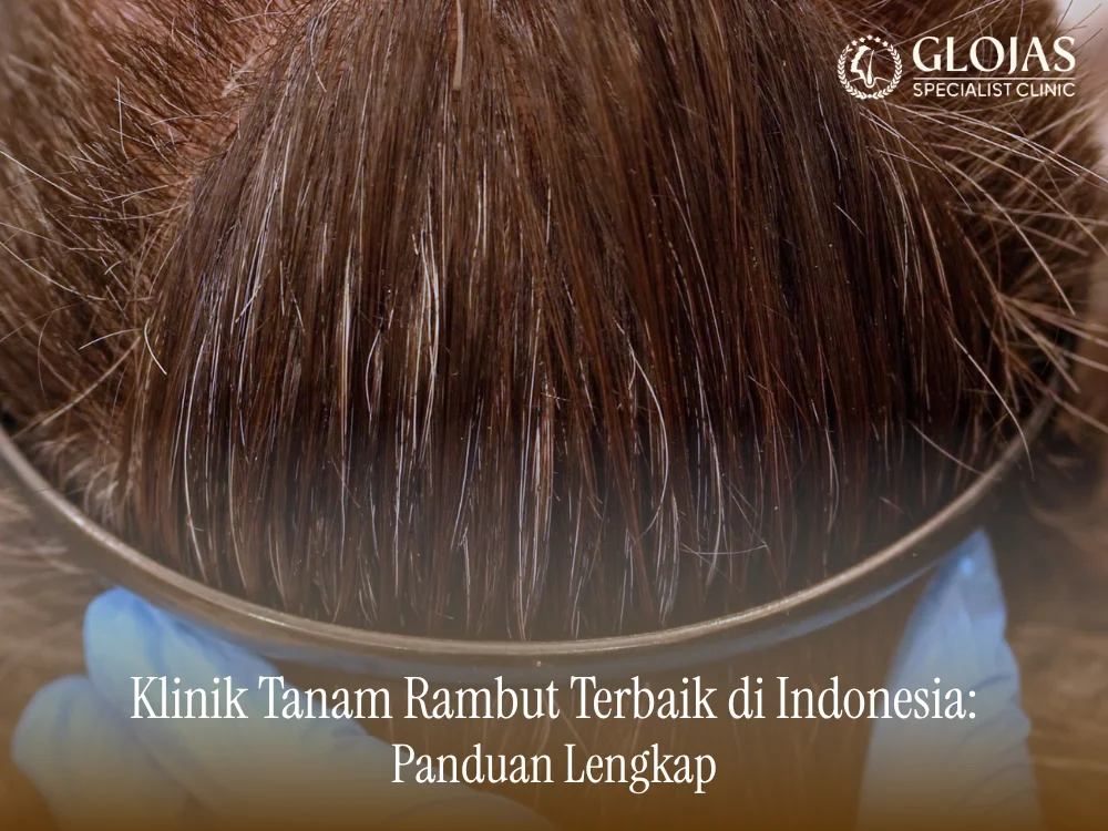 klinik-tanam-rambut-terbaik-di-indonesia