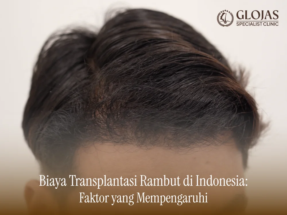 biaya-transplantasi-rambut-di-indonesia