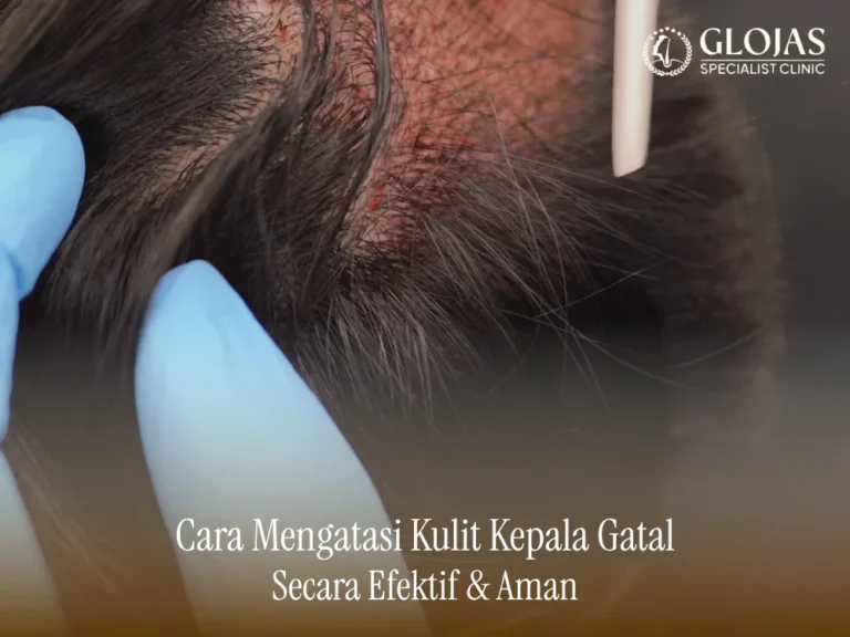 cara-mengatasi-kulit-kepala-gatal