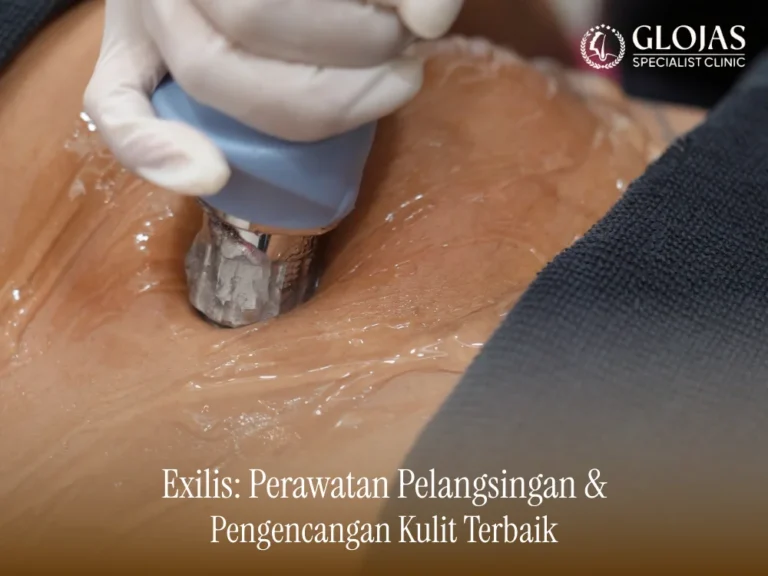 exilis