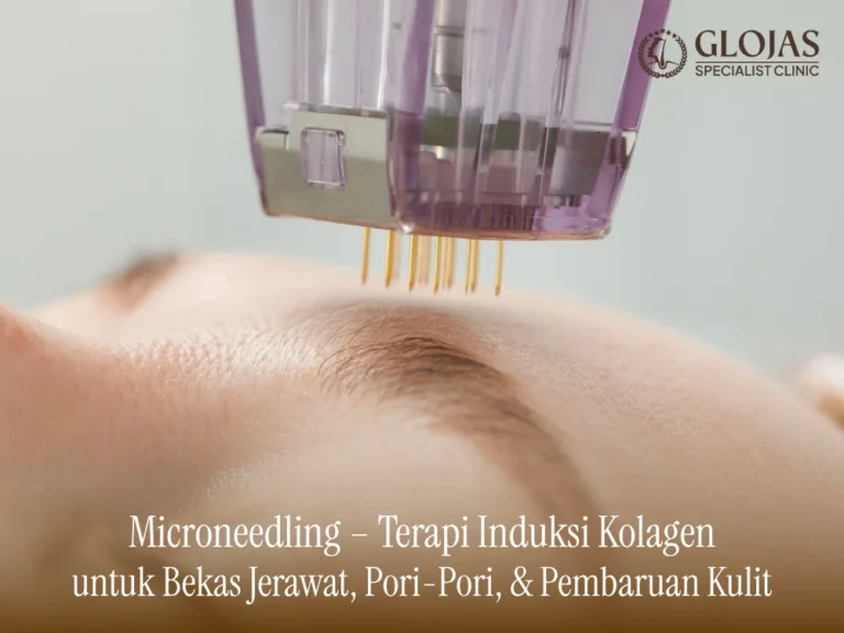 microneedling