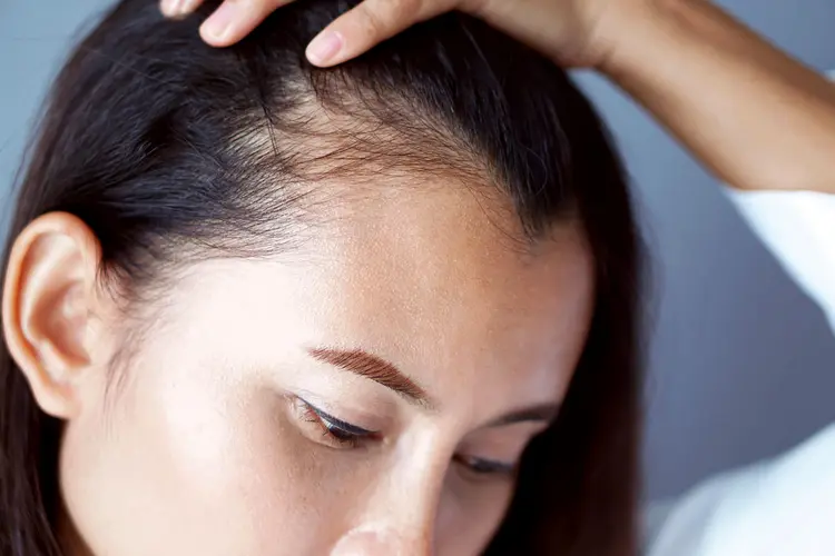 rambut-rontok-perempuan