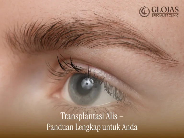 transplantasi-alis
