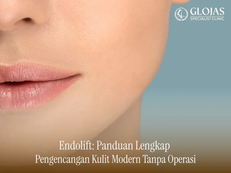 endolift