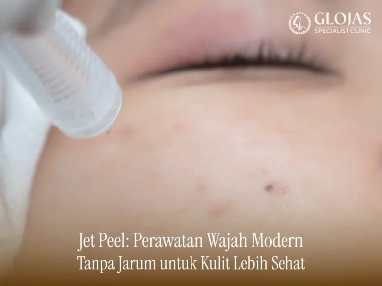jet-peel
