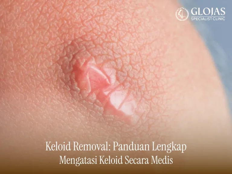 keloid-removal