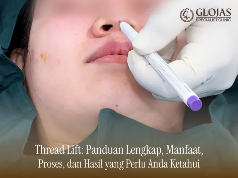 thread-lift-panduan-lengkap
