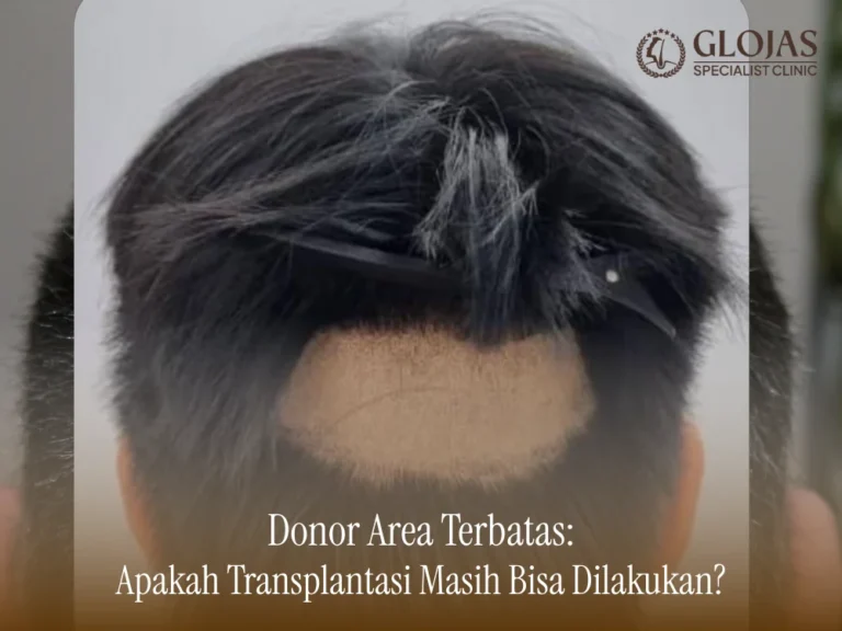 donor-area