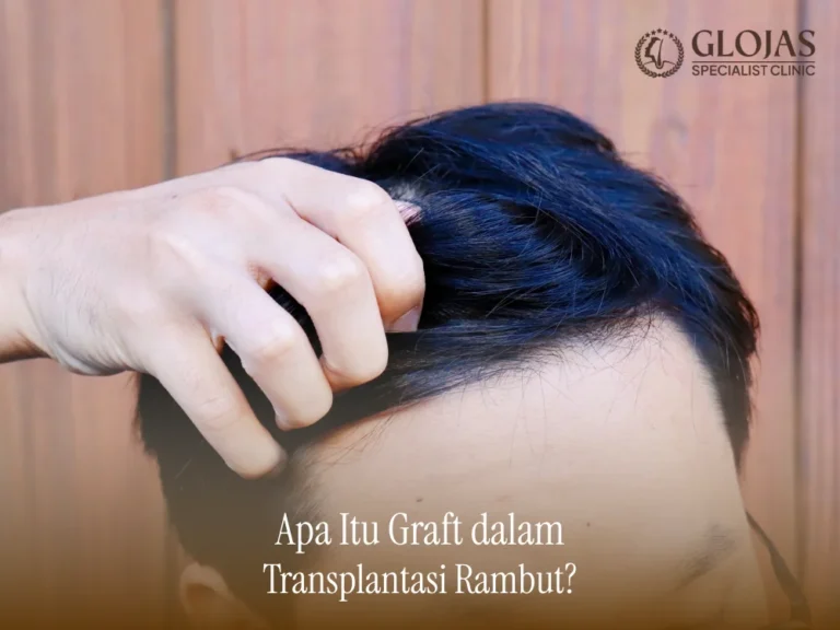 graft-dalam-transplantasi-rambut