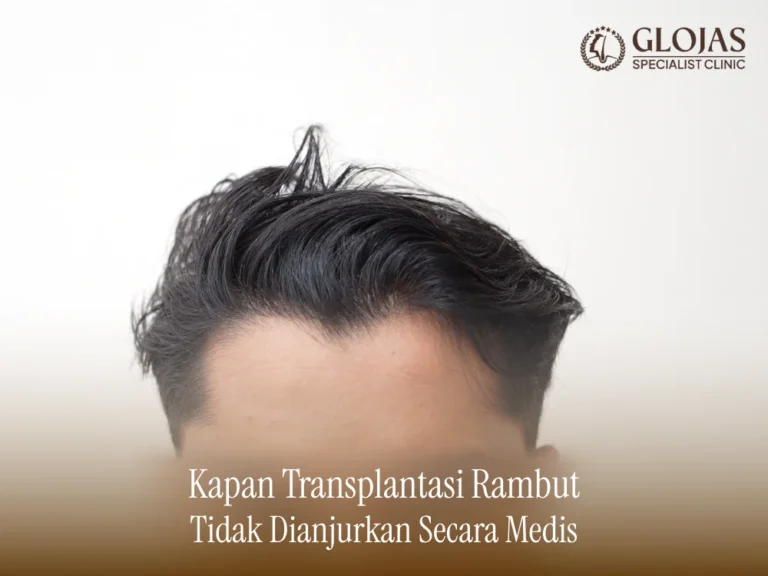 kapan-transplantasi-rambut