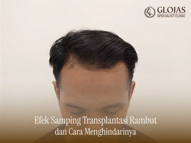 efek-samping-transplantasi-rambut