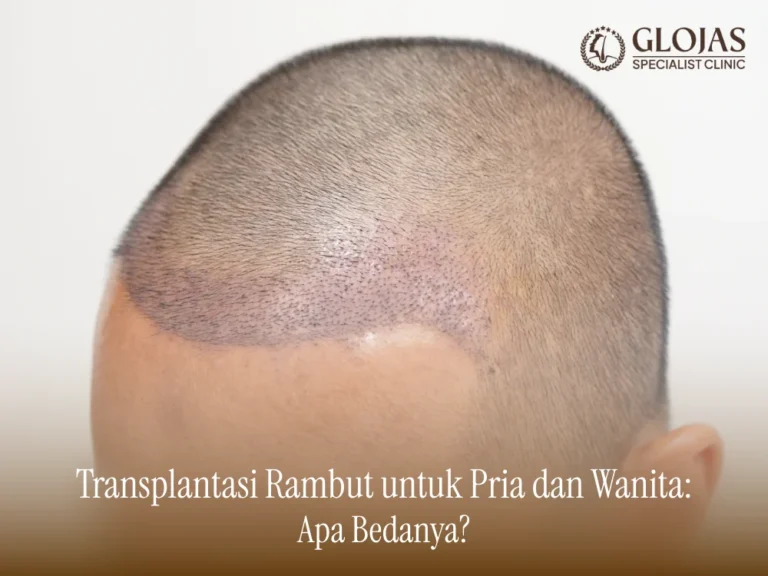 transplantasi-rambut-untuk-pria-dan-wanita
