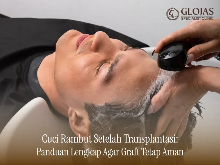 cuci-rambut-setelah-transplantasi