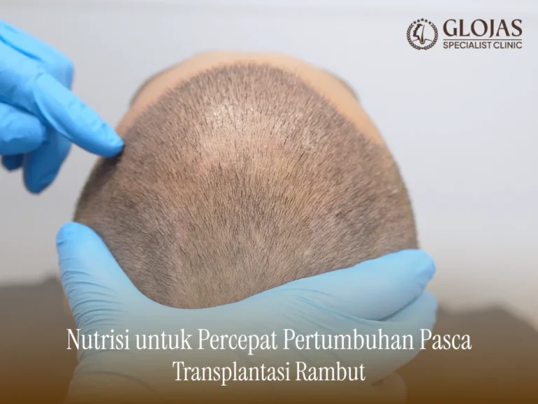 nutrisi-pasca-transplantasi-rambut