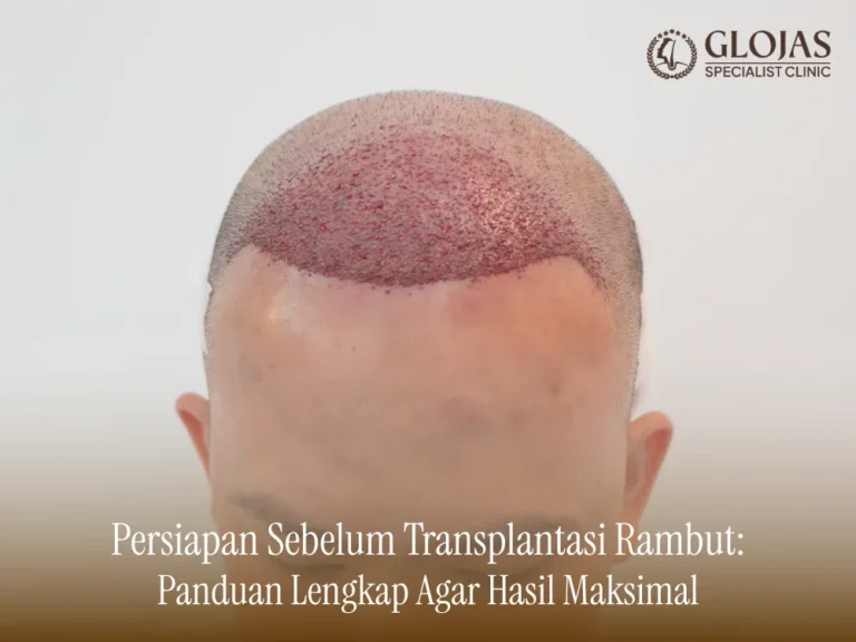 persiapan-sebelum-transplantasi-rambut