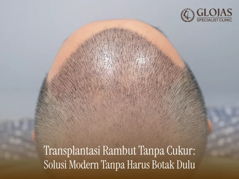 transplantasi-rambut-tanpa-cukur
