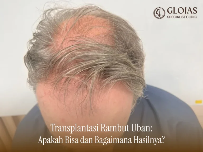 transplantasi-rambut-uban