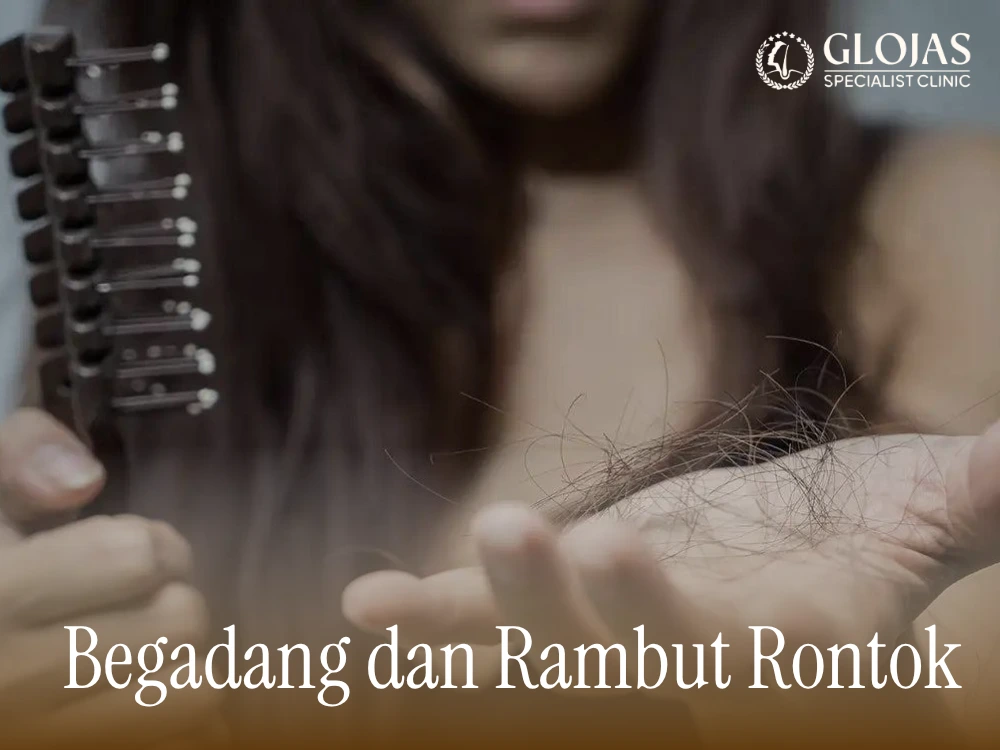 begadang dan rambut rontok