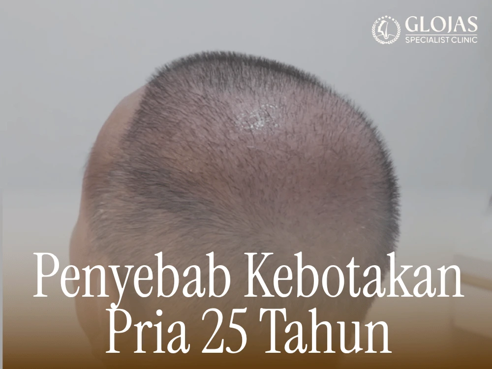 kebotakan dini