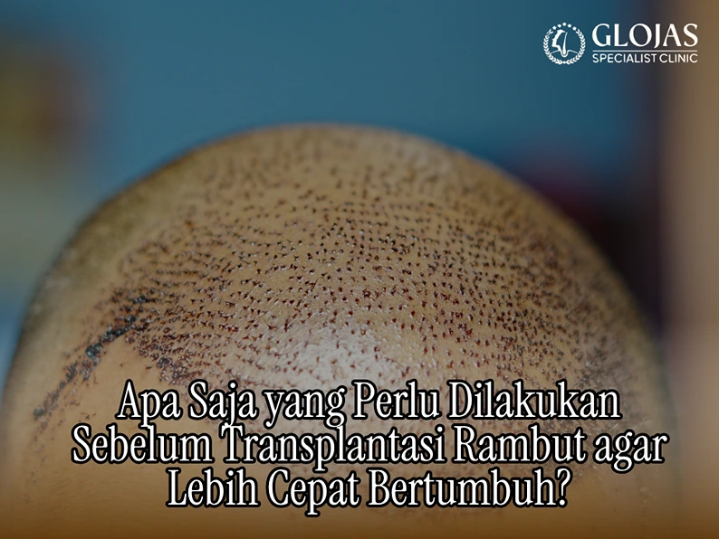 tanam rambut glojas