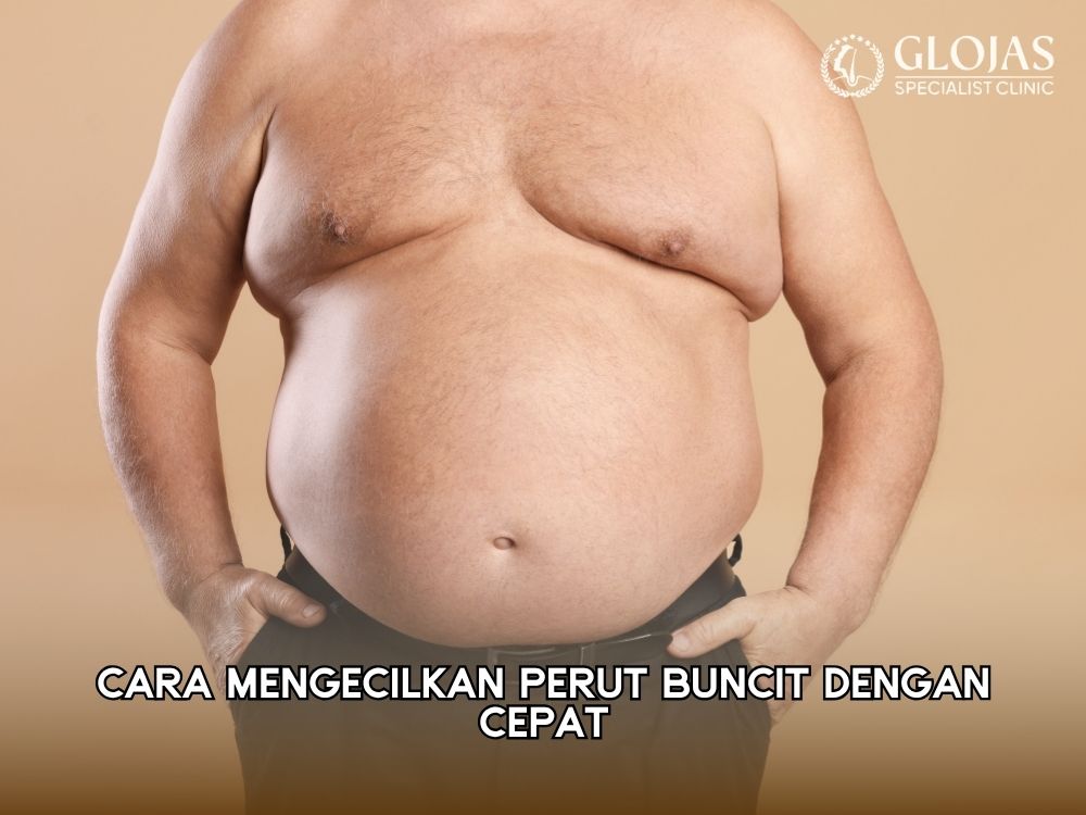cara mengecilkan perut buncit