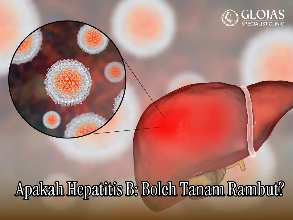 Hepatitis B: Apakah Bisa Tanam Rambut?