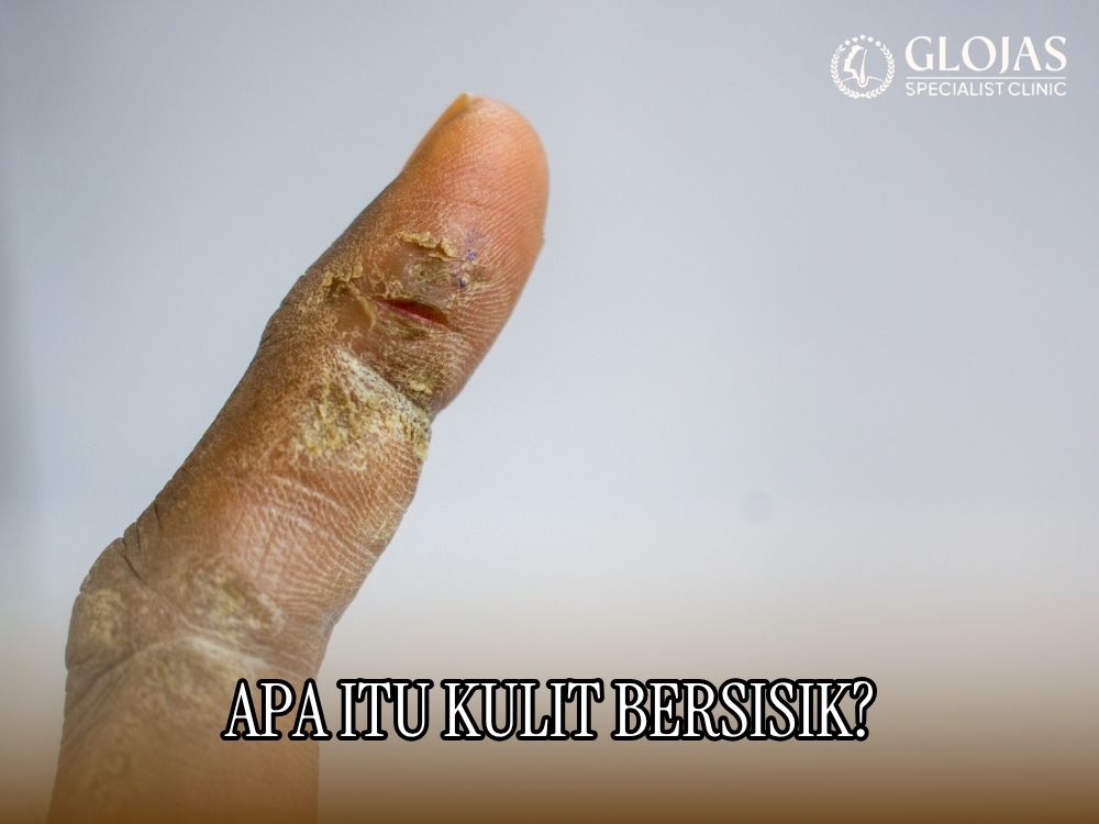 kulit bersisik